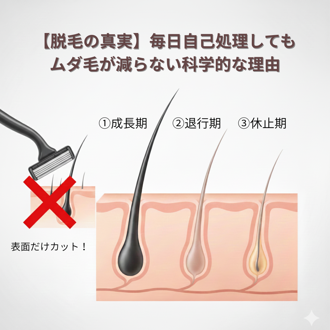 【脱毛の真実】毎日自己処理してもムダ毛が減らない科学的な理由